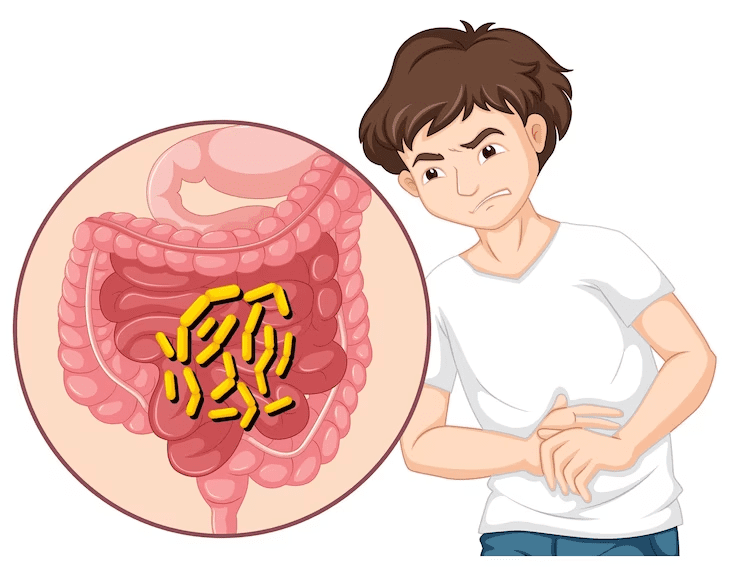 Common Digestive System Disorders